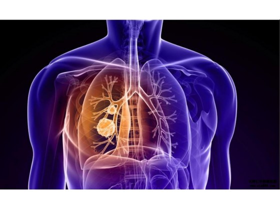 小细胞肺癌(Small cell lung cancer)（中）