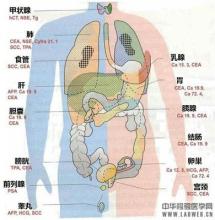 各类肿瘤的标志物及其临床意义