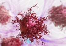 【TR文献】硫氧还蛋白还原酶在宫颈癌中的诊断价值
